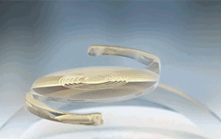 수정체낭에 인공수정체 렌즈 삽입