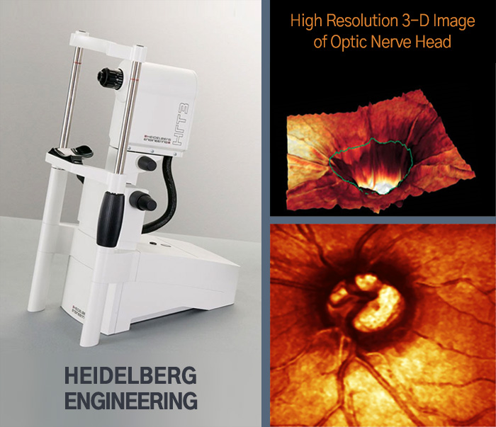 High Resolution 3-D Image of Optic Nverve Head