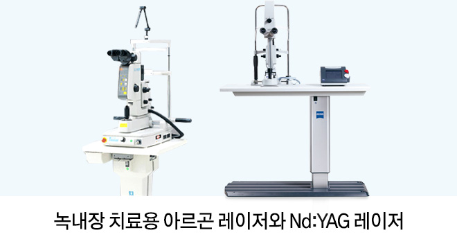 녹내장 치료용 아르곤 레이저와 Nd:YAG 레이저