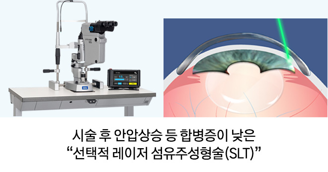 시술 후 안압상승 등 합병증이 낮은 '선택적 레이저 섬유주성형술(SLT)'